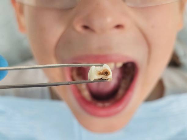 Best Emergency Denture Repair in Queensland, MD
